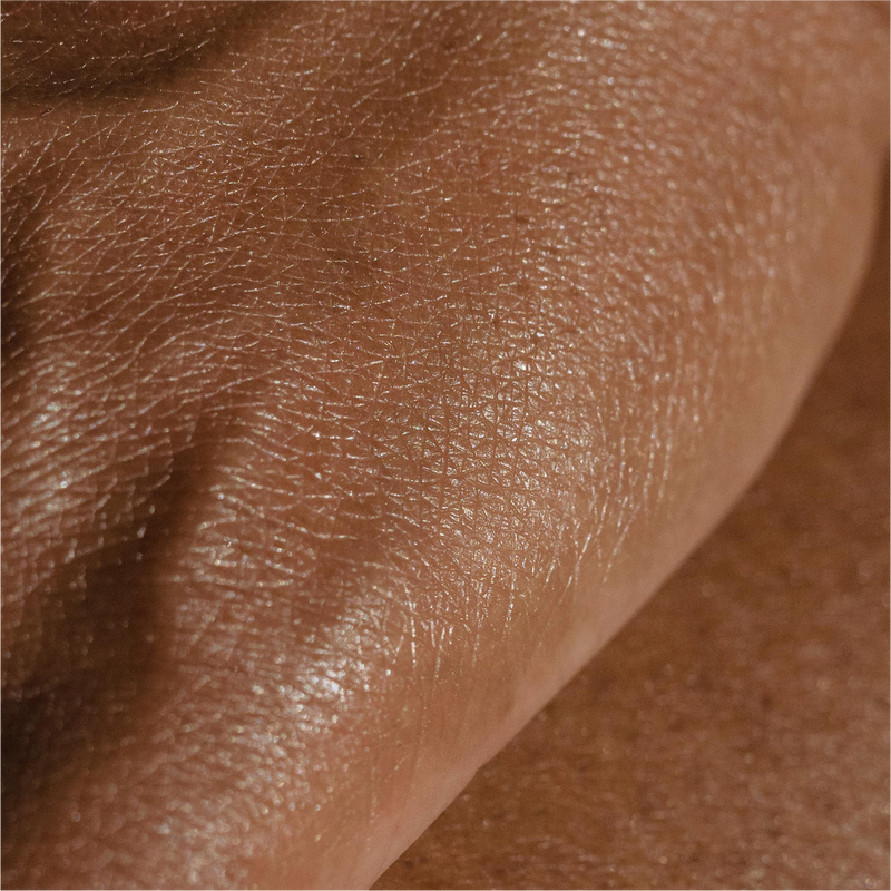 The Most Commonly Misdiagnosed Skin Conditions
