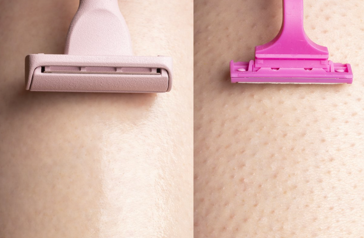 Say Goodbye to Razor Burn for Good! – hanni